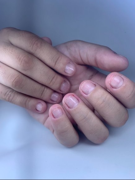 Unhas roídas antes da transformação realizada por Grazi Souza